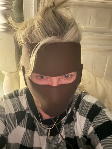 Customer photo review of JOVS 4D Laser Light Therapy Mask