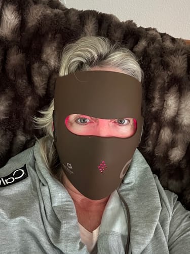 Customer photo review of JOVS 4D Laser Light Therapy Mask
