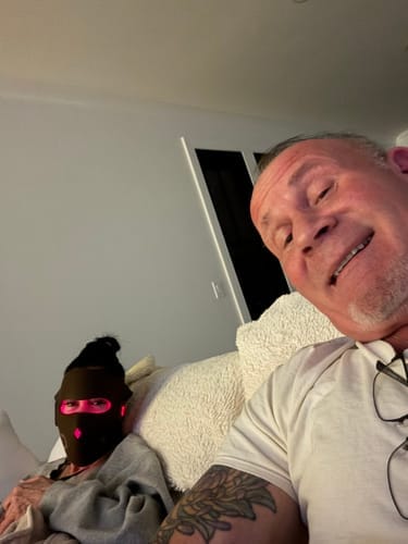 Customer photo review of JOVS 4D Laser Light Therapy Mask