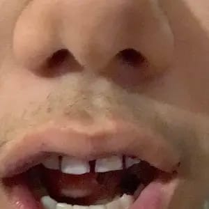 Customer photo review of Viralaluna™ Purple Teeth Whitening Strips