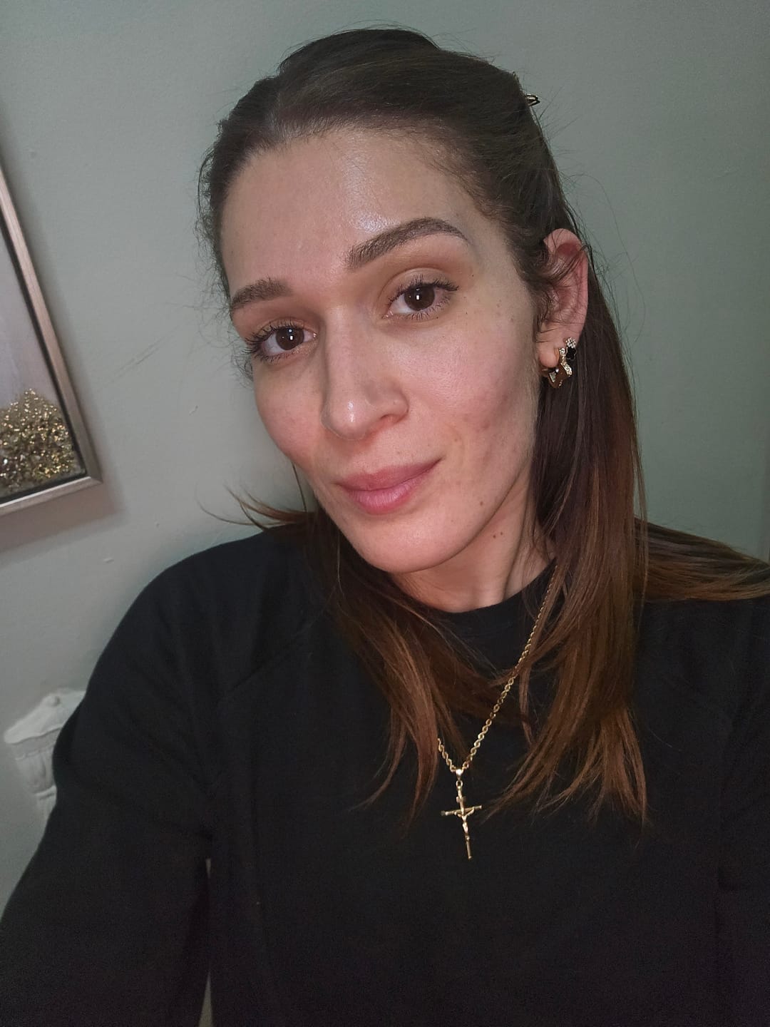 Customer photo review of Salicylic Acid Acne-Clearing 4-Piece Set
