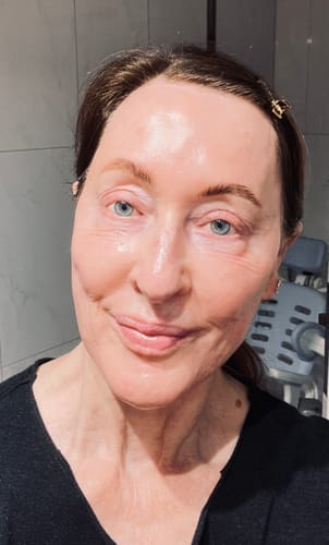 Customer photo review of JOVS 4D Laser Light Therapy Mask