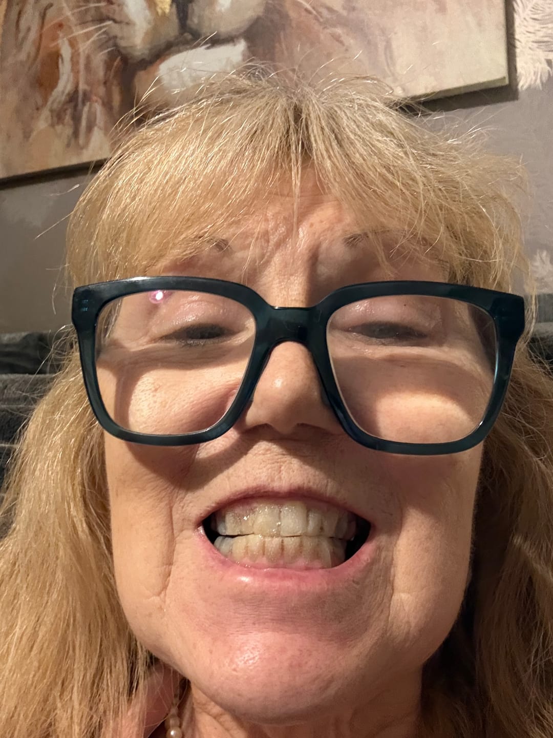 Customer photo review of Teeth Whitening Pen