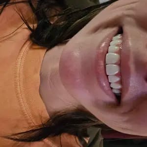 Customer photo review of Viralaluna™ Purple Teeth Whitening Strips