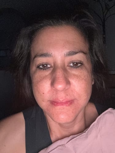 Customer photo review of LIFTEYA® - Effet Lifting Sans Chirurgie