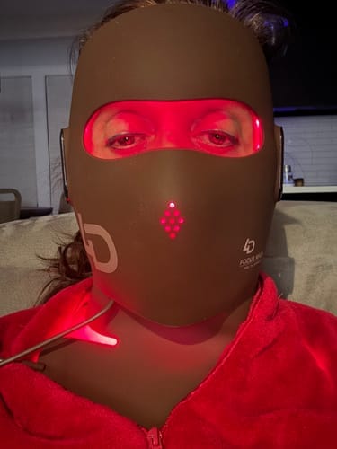 Customer photo review of JOVS 4D Laser Light Therapy Mask