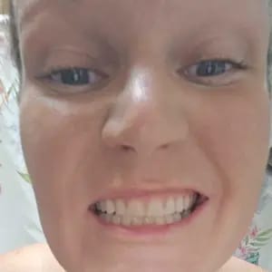 Customer photo review of Viralaluna™ Purple Teeth Whitening Strips