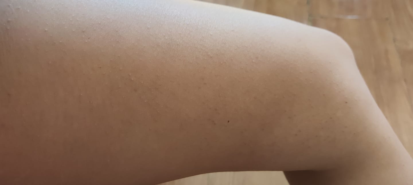 Customer photo review of Exfoliante La Citricolita