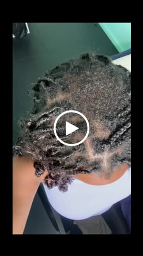 Customer video review of New Formula: Root Stimulating Serum (50ml)