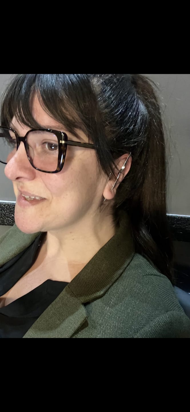 Customer photo review of LIGHTNING BOLT-ŞİMŞEK ÇARPMASI