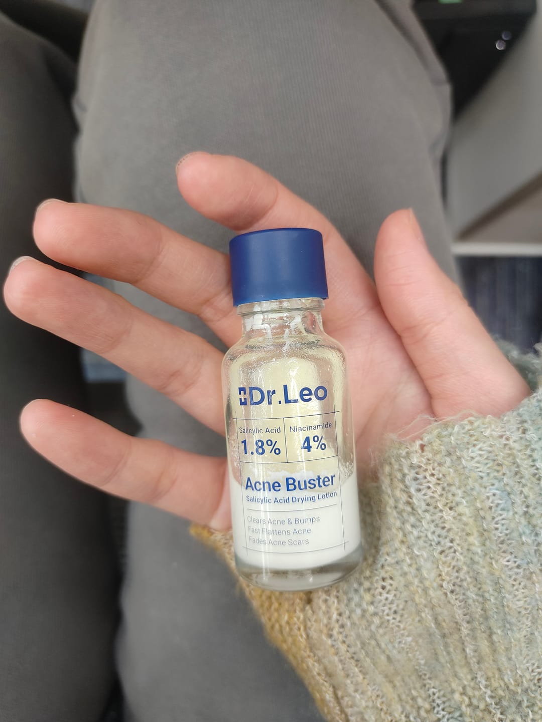 Customer photo review of Acne Drying Lotion Plus (1.8% Encapsulated Salicylic Acid) — 20 mL
