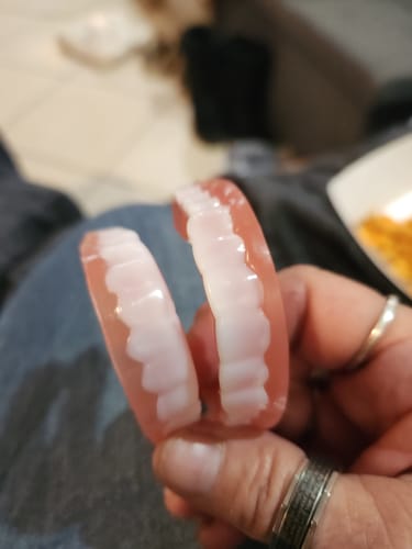 Customer photo review of 🦷  Fit Full Functional DenturesMake you more confident-Made in the USA & FDA-Certified