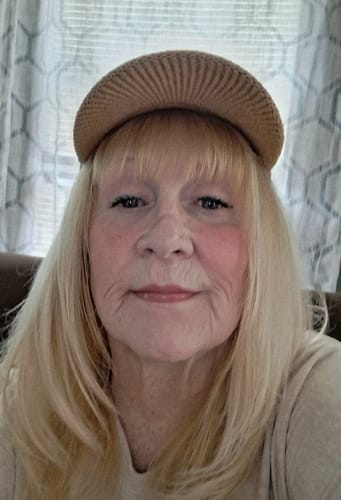A reviewer's close-up photo showing their skin's appearance after using the Seranova Micro Infusion System.