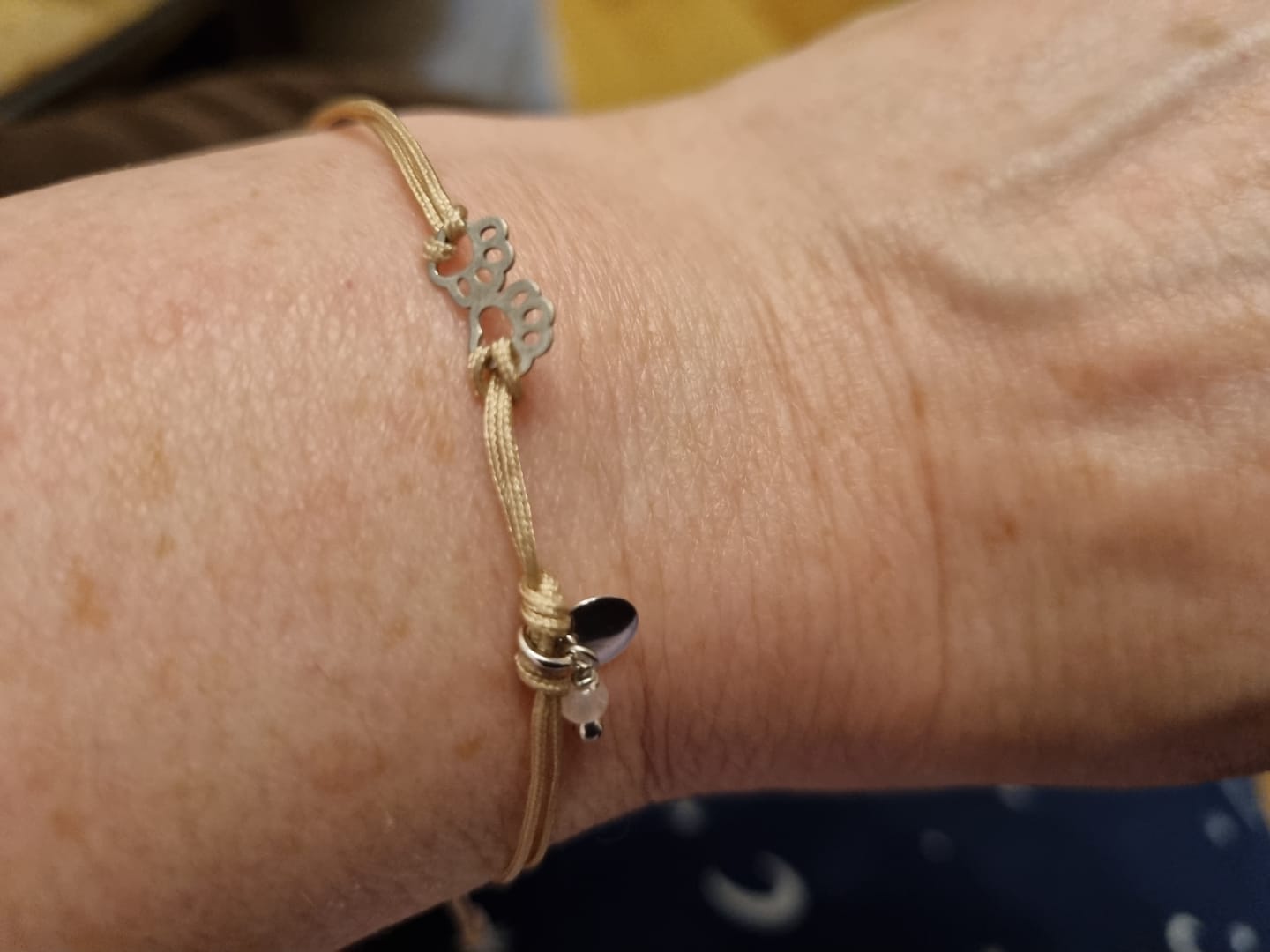 Customer photo review of Pawsitive Armband