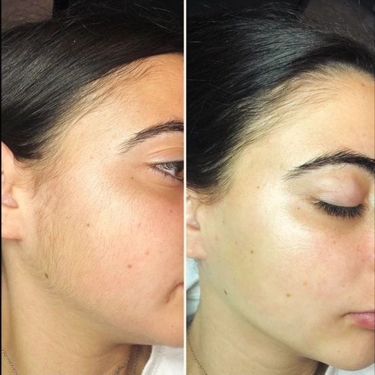 Customer photo review of SkinUp Pro