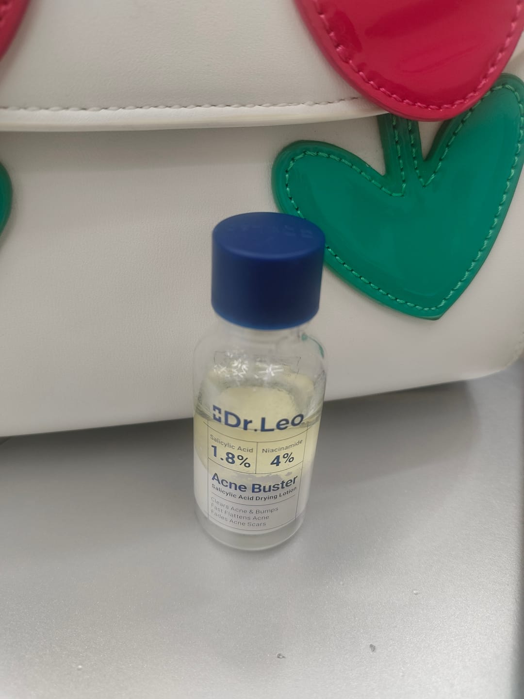 Customer photo review of Acne Drying Lotion Plus (1.8% Encapsulated Salicylic Acid) — 20 mL