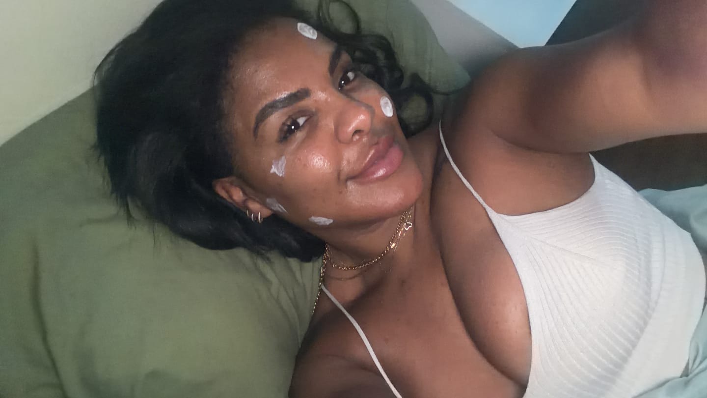 Customer photo review of Acne Drying Lotion Plus — 2 Pack (20 mL × 2)