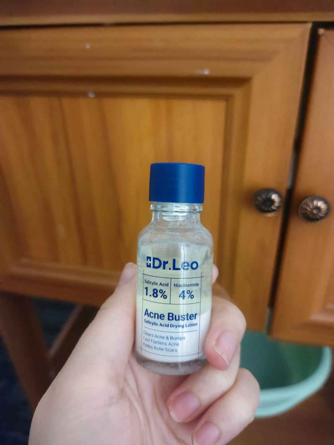 Customer photo review of Acne Drying Lotion Plus (1.8% Encapsulated Salicylic Acid) — 20 mL