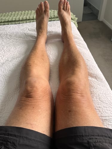 Customer photo review of Melanoboost Peptide Sun Tanning Lotion