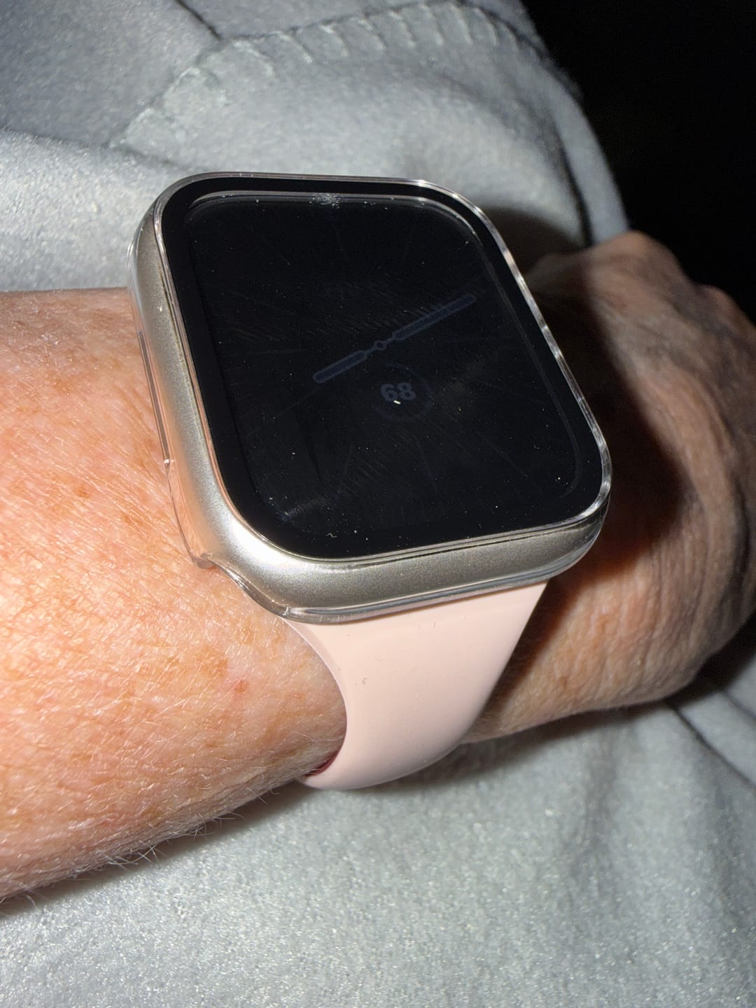 Customer photo review of All-in-one classic Apple Watch Protection Case