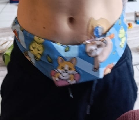 Customer photo review of Insulin Pump Waist Belt for small children - Dia-BellyBand MINI