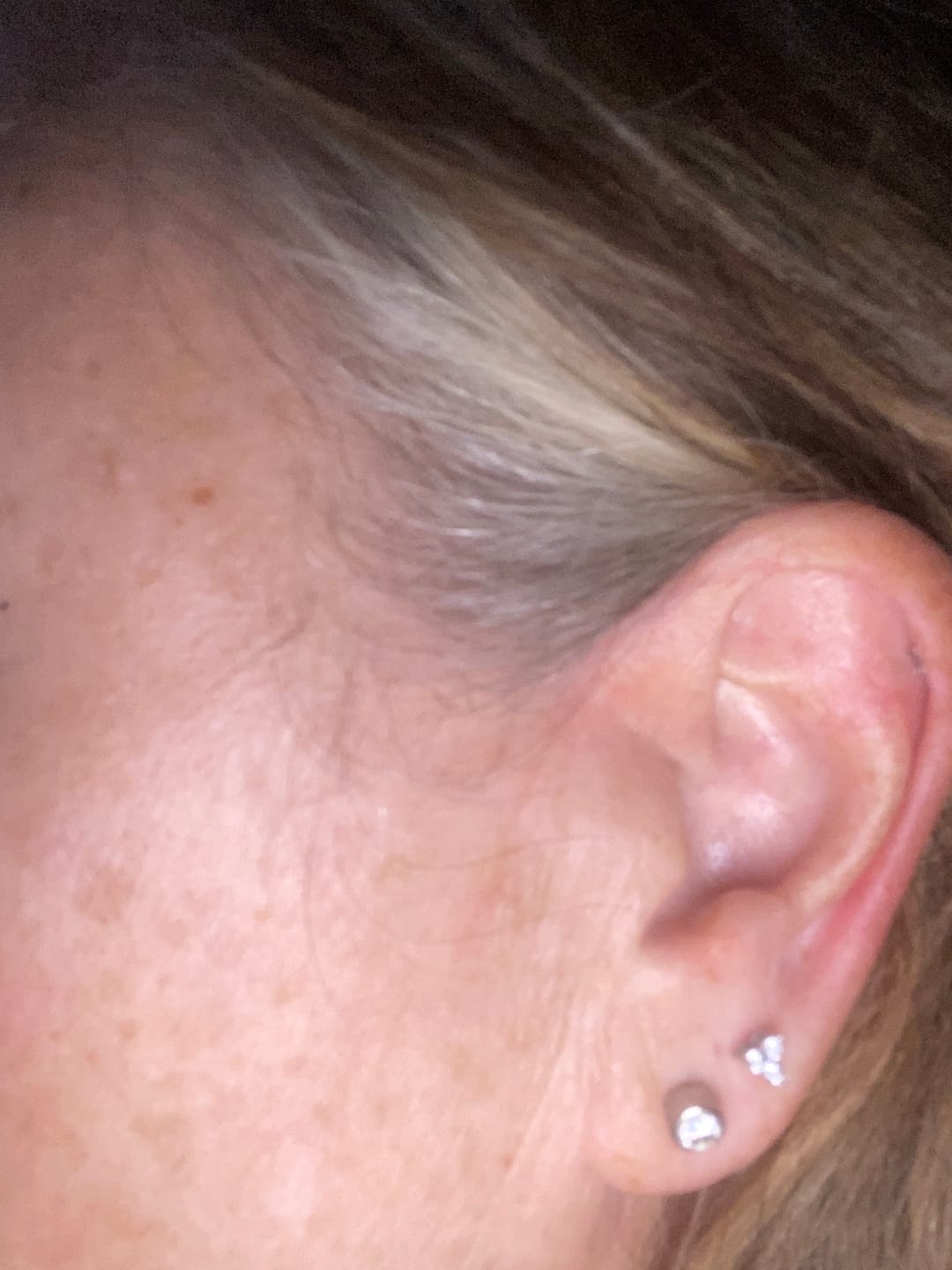 Customer photo review of Versa Trinity Lab Grown Diamond Sleep Stud Earrings