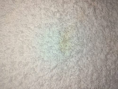 Customer photo review of myBIANCA Discovery Bundle