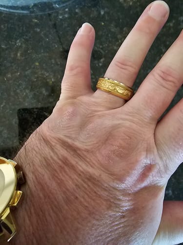 A customer's hand wearing the textured gold Aureum ring on their finger, with a gold watch partially visible.