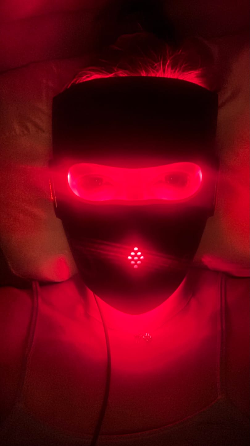 Customer photo review of JOVS 4D Laser Anti-Aging Therapy Mask