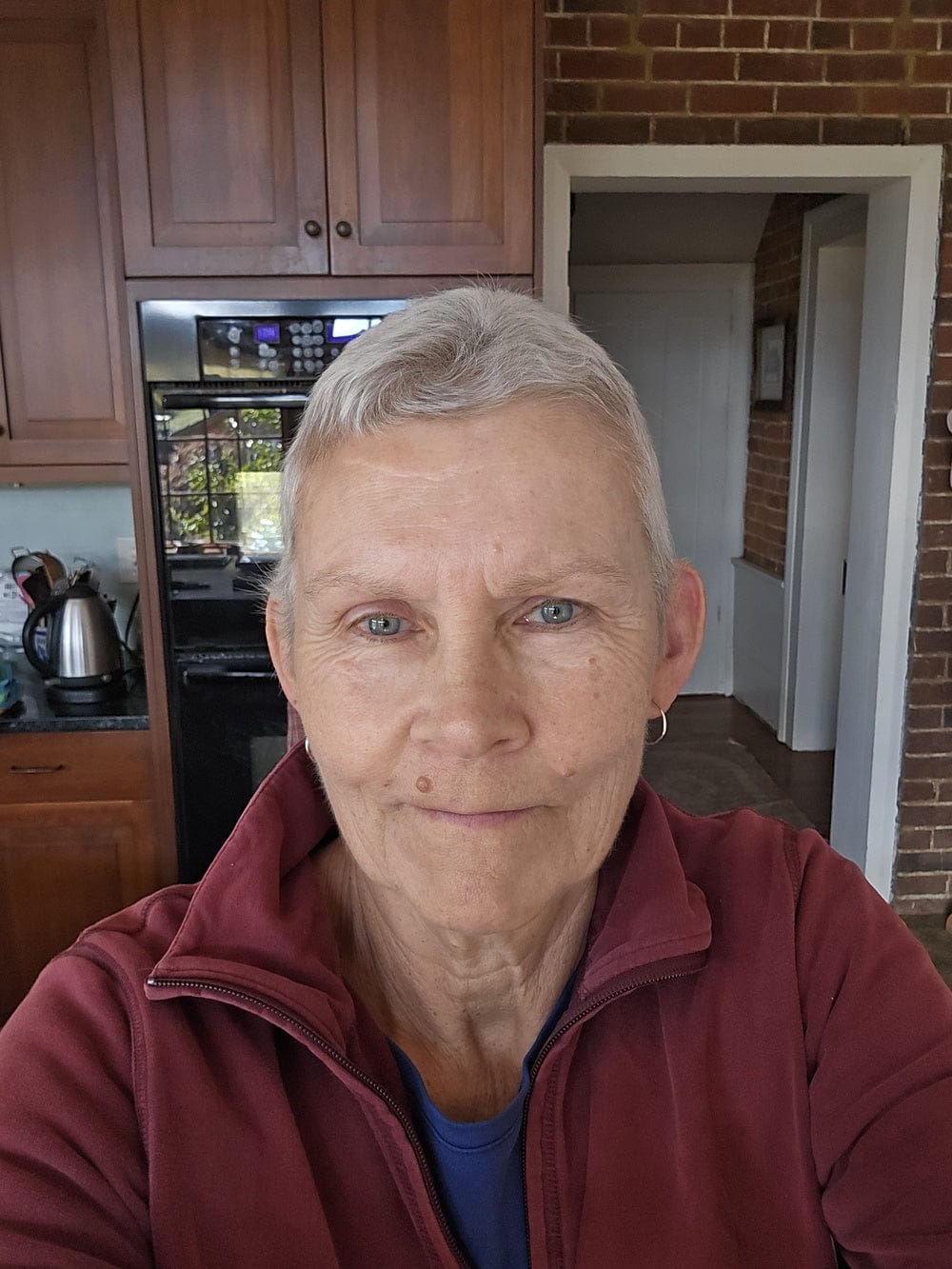 Customer photo review of Hair Growth Hero Bundle