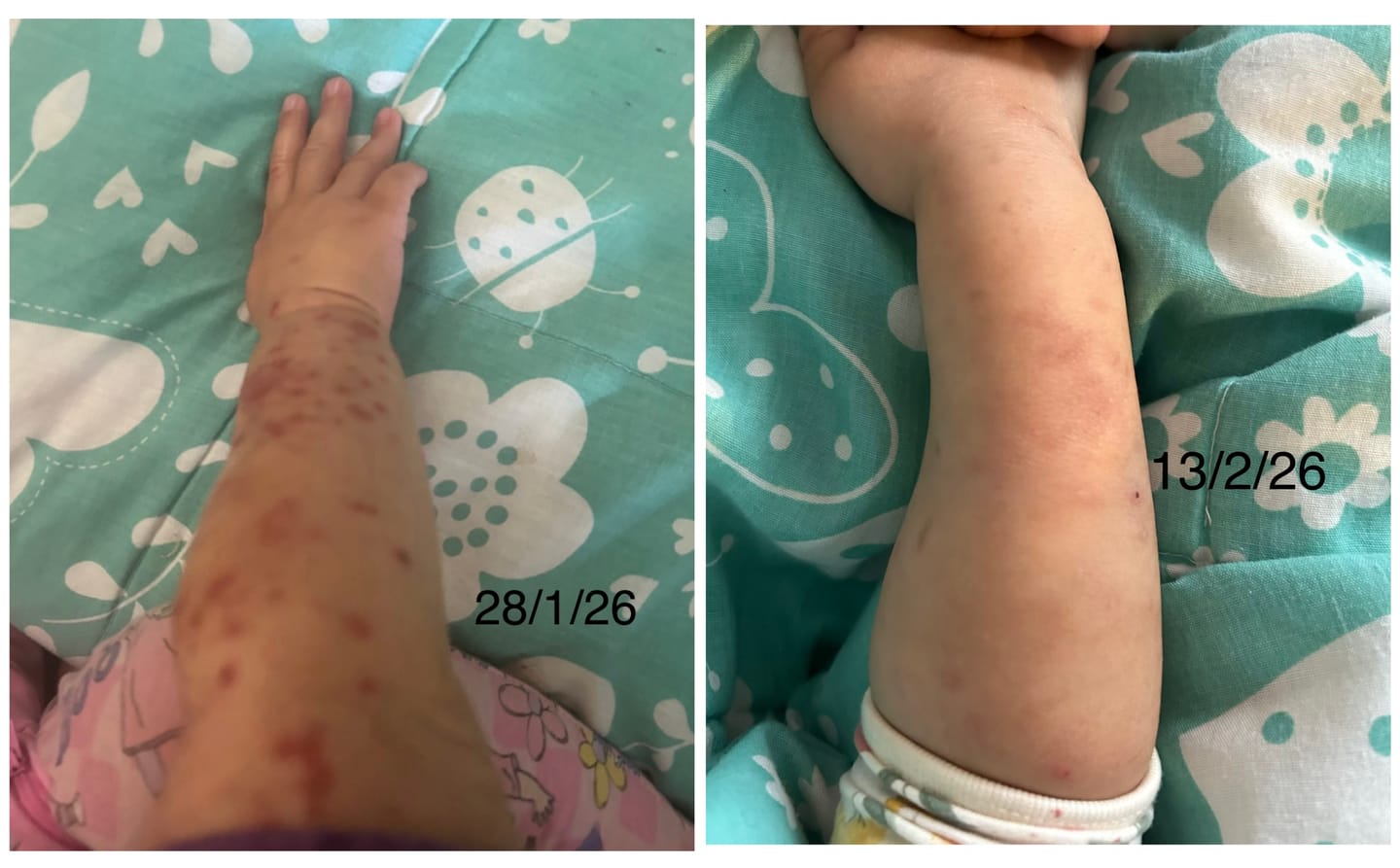Customer photo review of Kawakawa Balm - Winner, Best SOS/Healing Balm