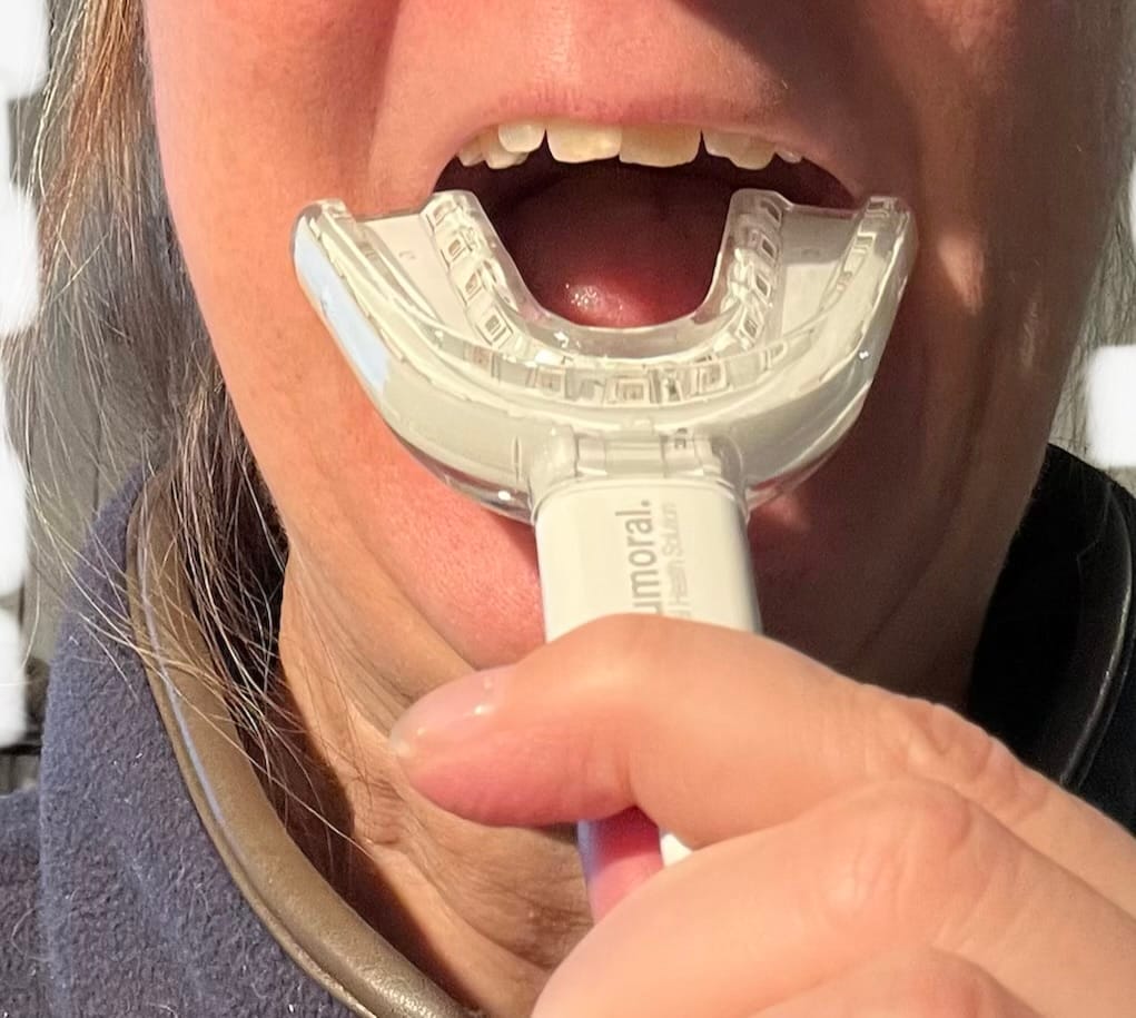 Customer photo review of Lumoral® startpakke