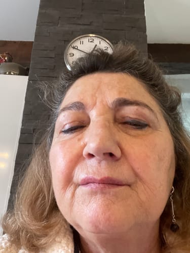Customer photo review of Miyora 24K Micro-Infusion Ritual