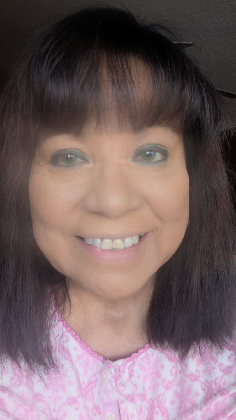 Customer photo review of Bellini Green Prescription Colored Contact Lenses