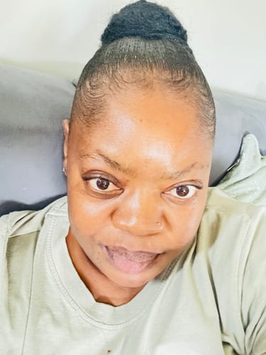 Customer photo review of Minoxidil High Strength (5%) SOLUTION, 3x60ml pack