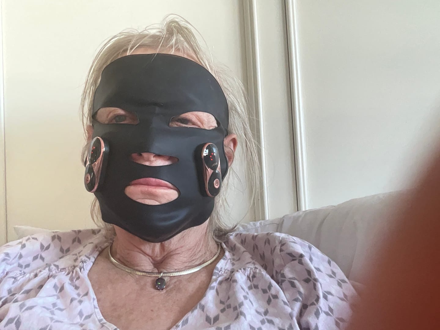 Customer photo review of JOVS EMS-Lifting Mask