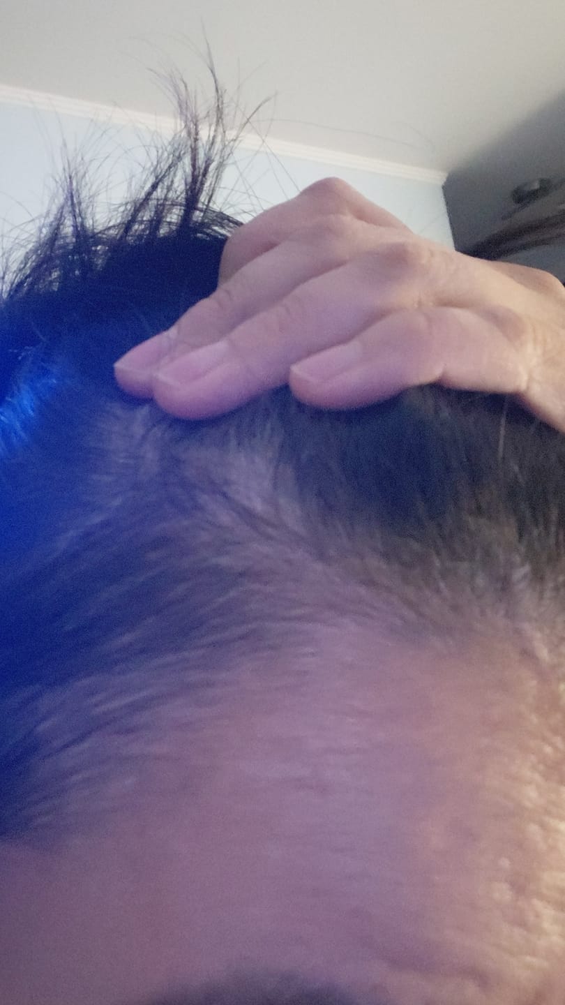 Customer photo review of Shampoo Anticaída