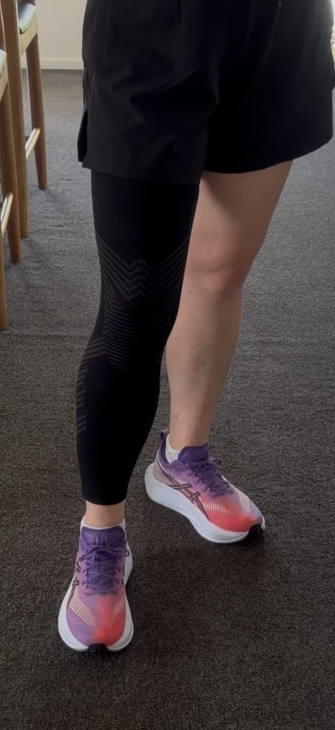 Customer photo review of KneeMax | Compression Sleeves for Knees and Legs