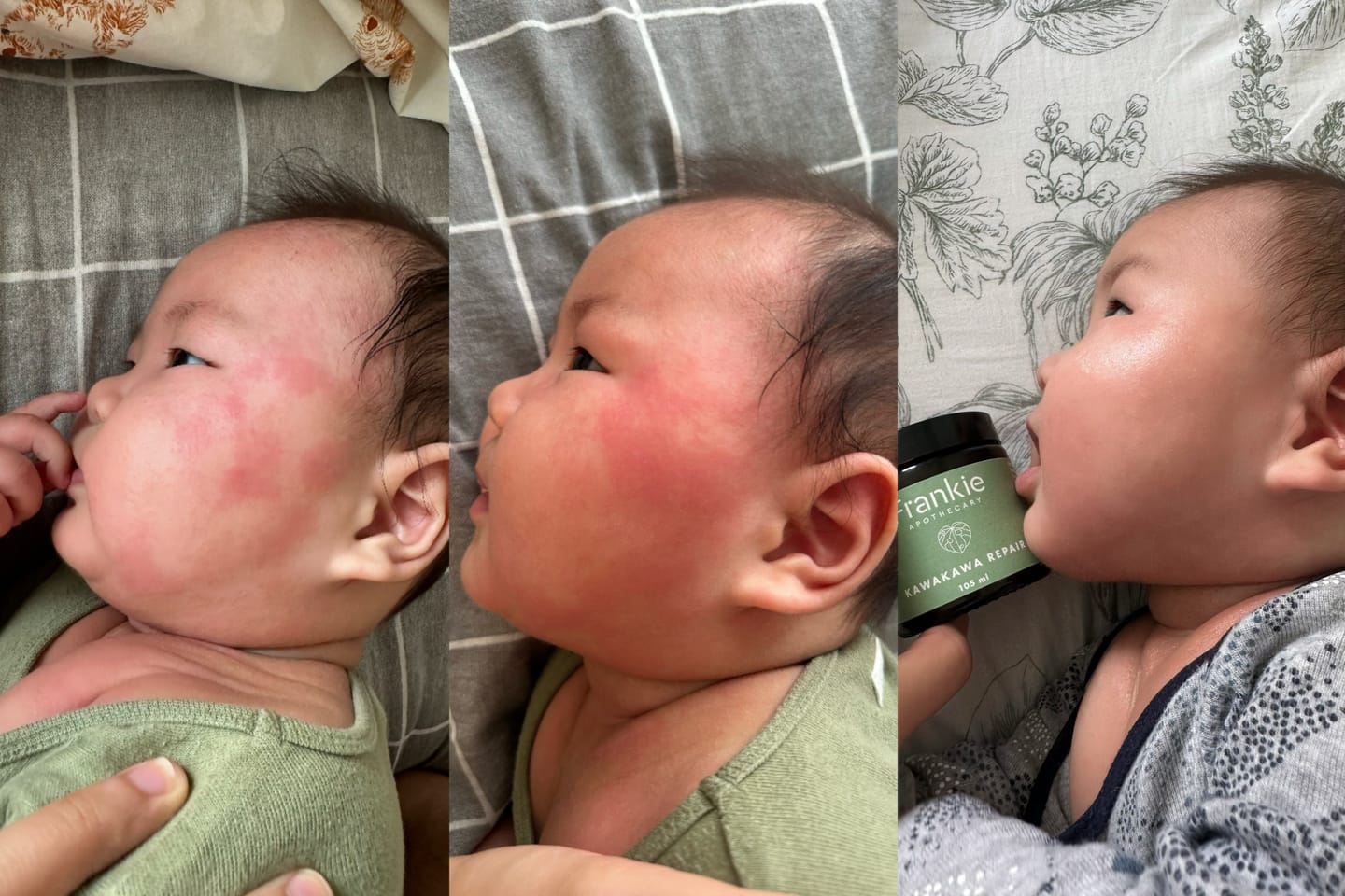 Customer photo review of Skin Hydration Duo - Save 5%