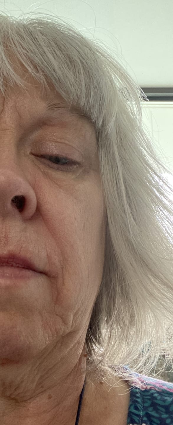 Customer photo review of Bovine Methylene Blue Tallow Balm (2 oz)