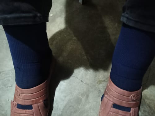 Customer photo review of Alivra™ Calcetas de Compresión de 20-30mmHg