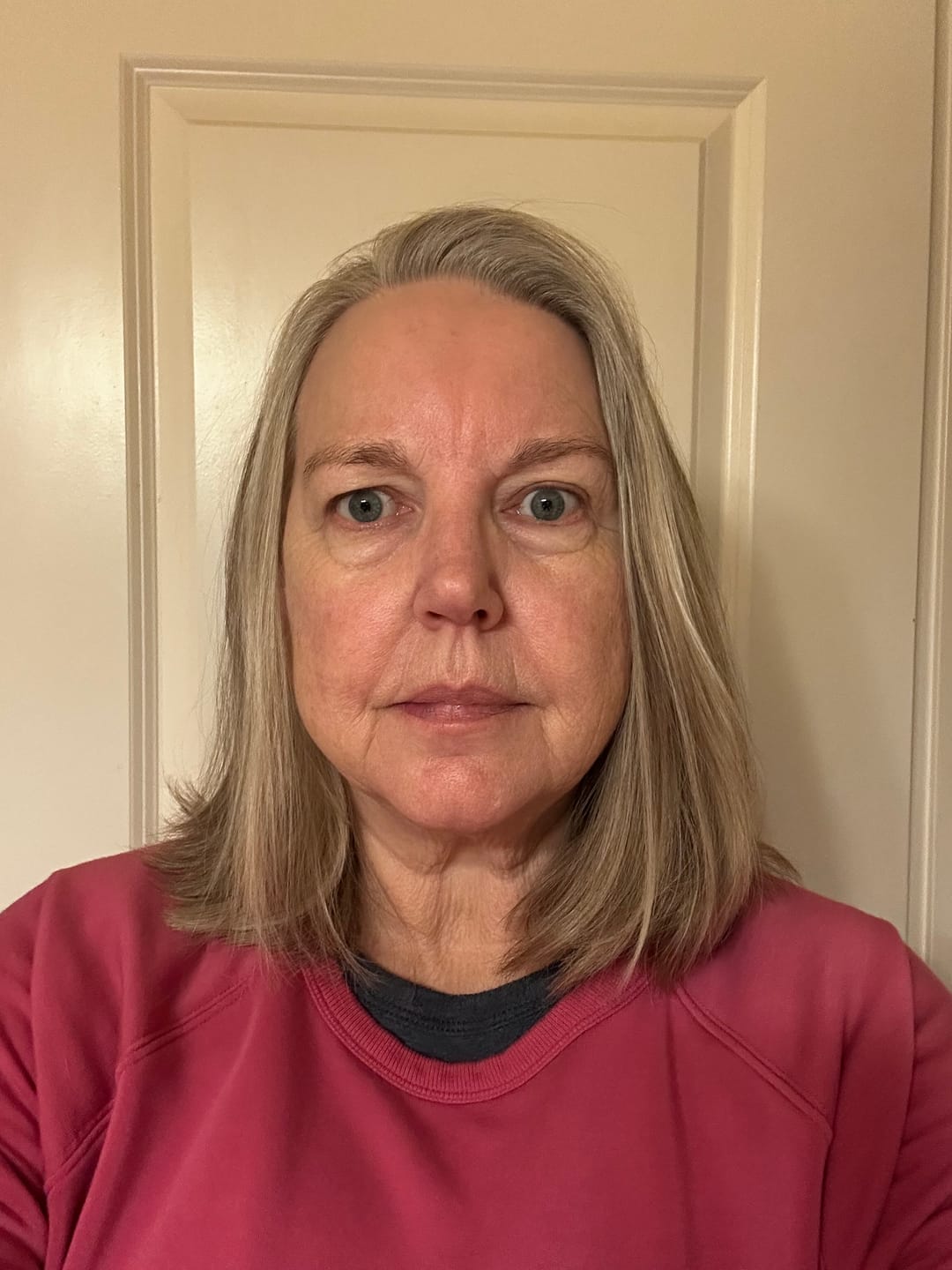 Customer photo review of The Complete System for Mature Women’s Skin