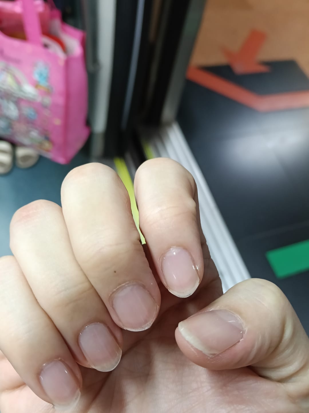 Customer photo review of Crystal Clear DIY Semicured Gel Nail Sticker Kit (STOP NAIL BITING & GROW BRITTLE NAILS)
