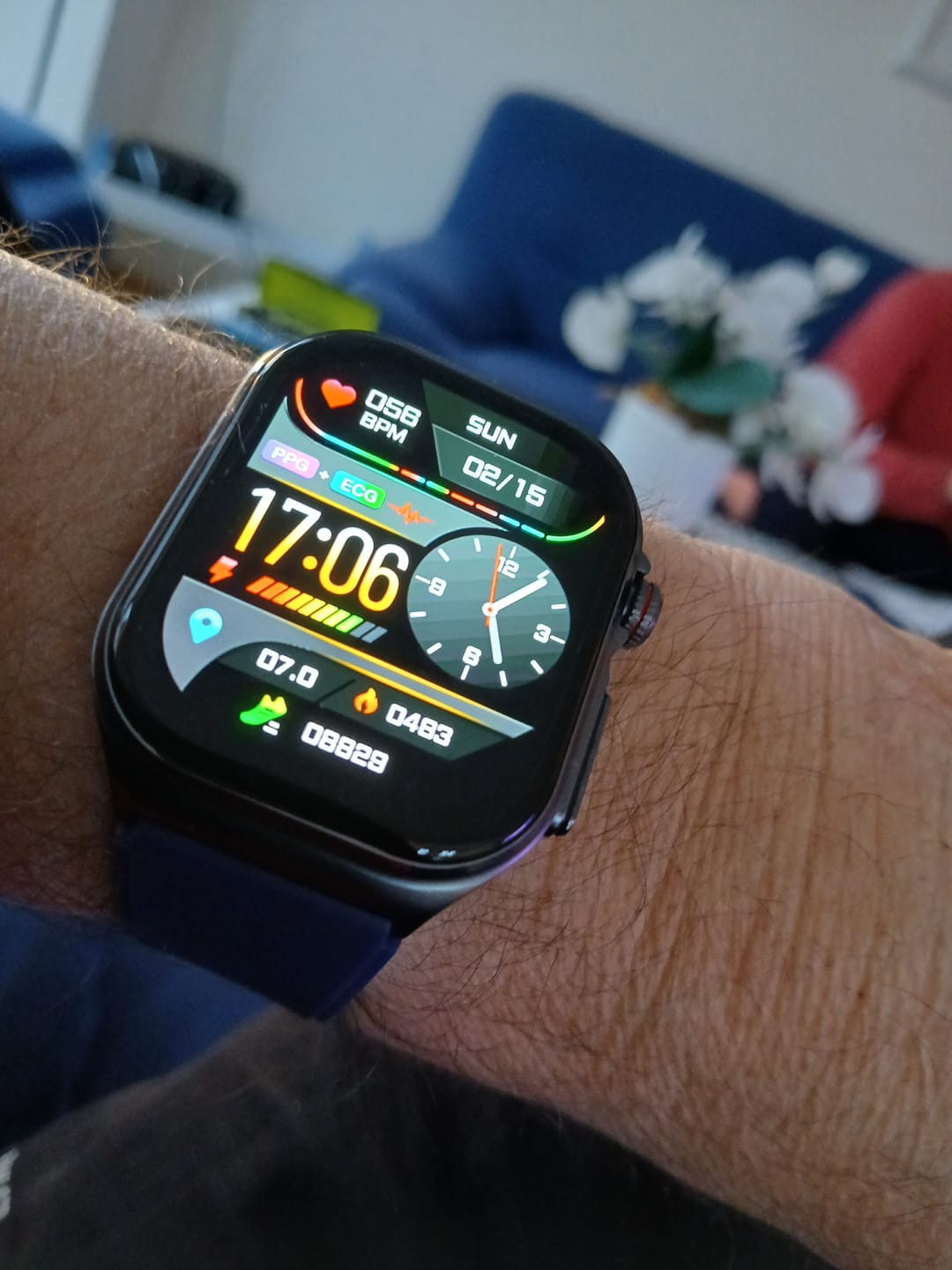 Customer photo review of Orthowatch Arca