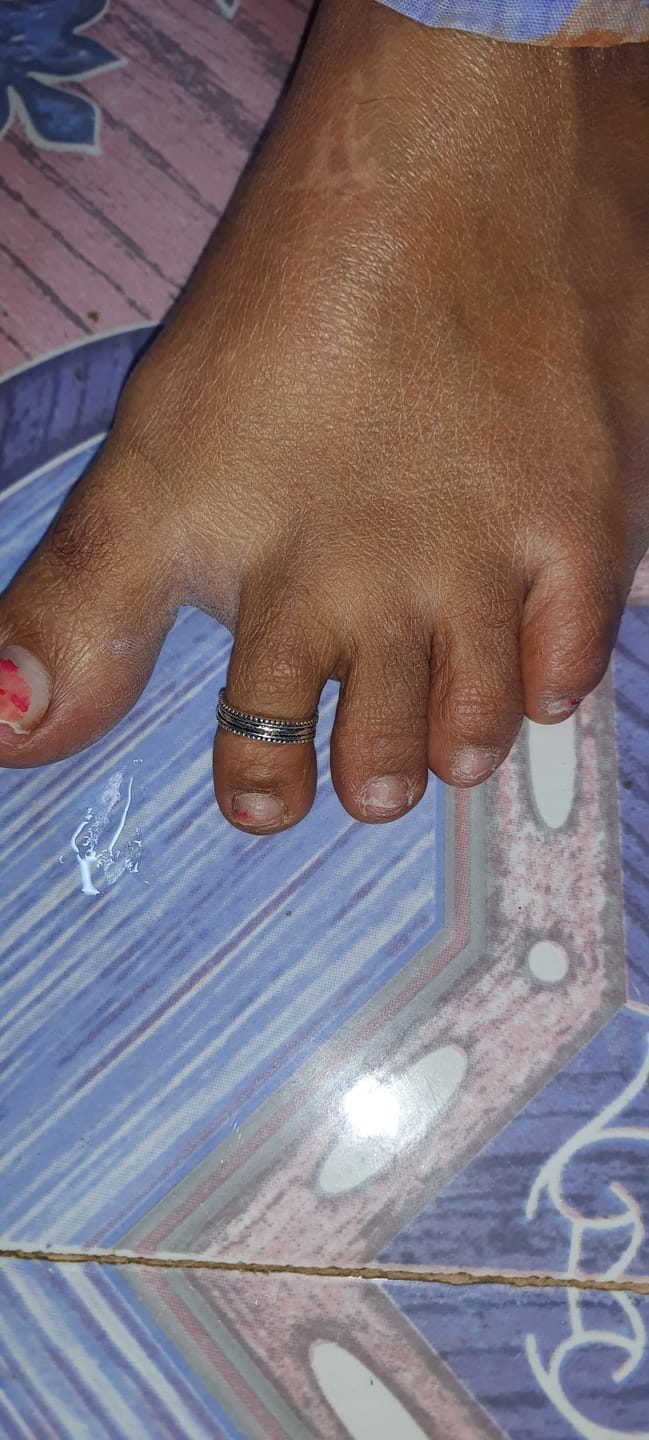 Customer photo review of Oxidised Silver Layered Bead Toe Ring