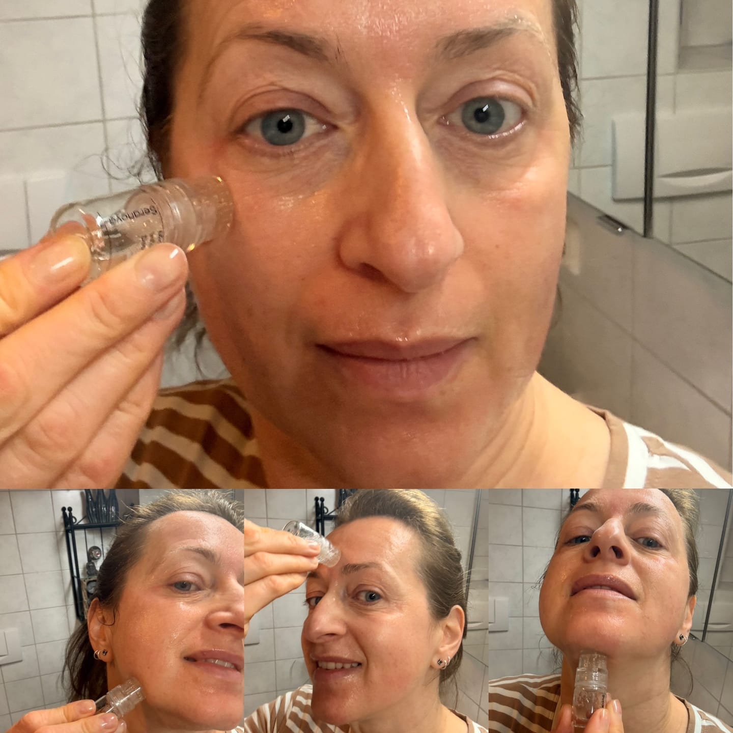 Customer photo review of Seranova Micro Infusion System™