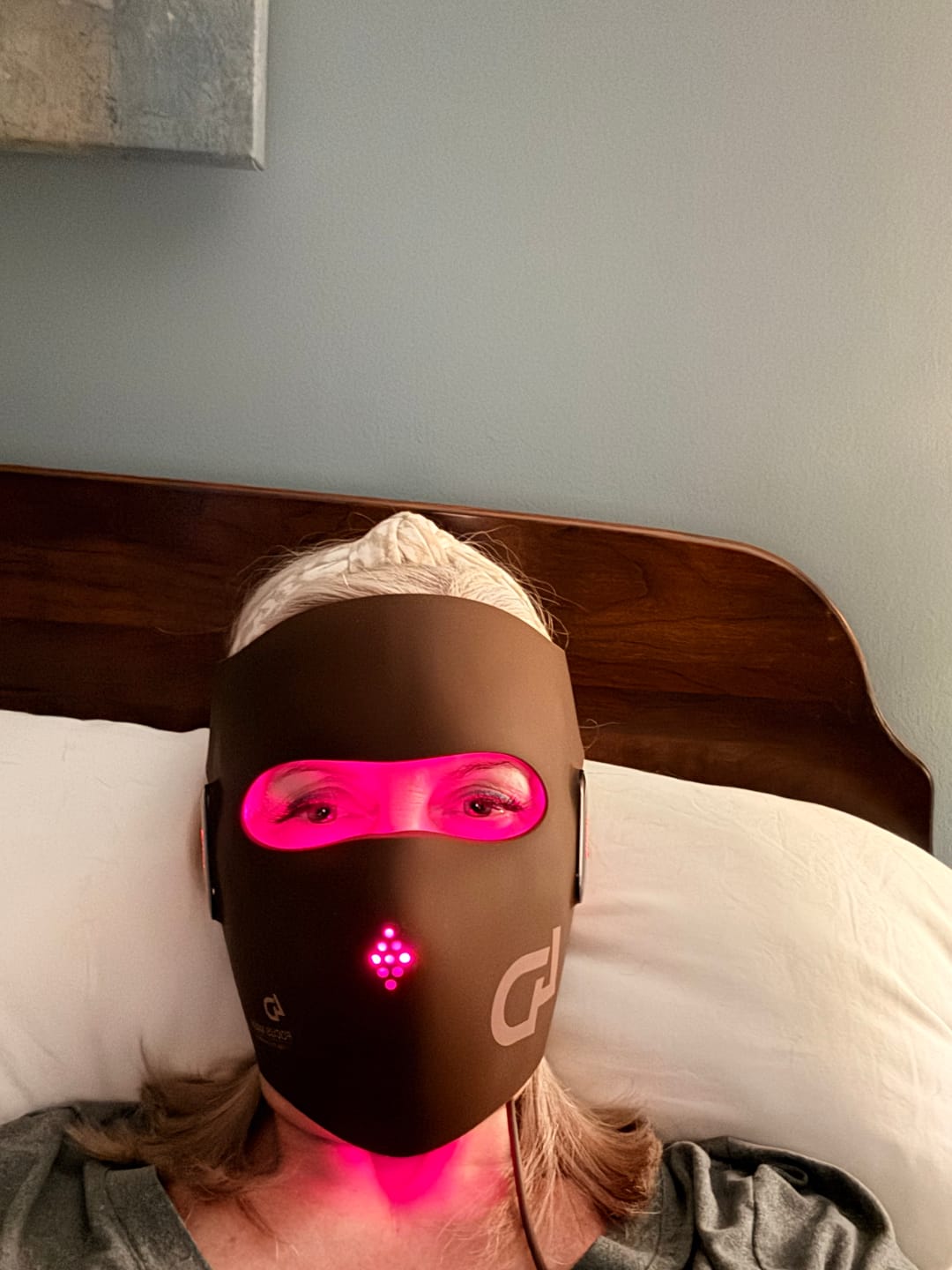 Customer photo review of JOVS 4D Laser Light Therapy Mask