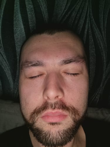 Customer photo review of Seb Natural Calming Serum