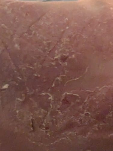 Close-up of a reviewer's foot with dry, flaky skin before using Calm Cream.