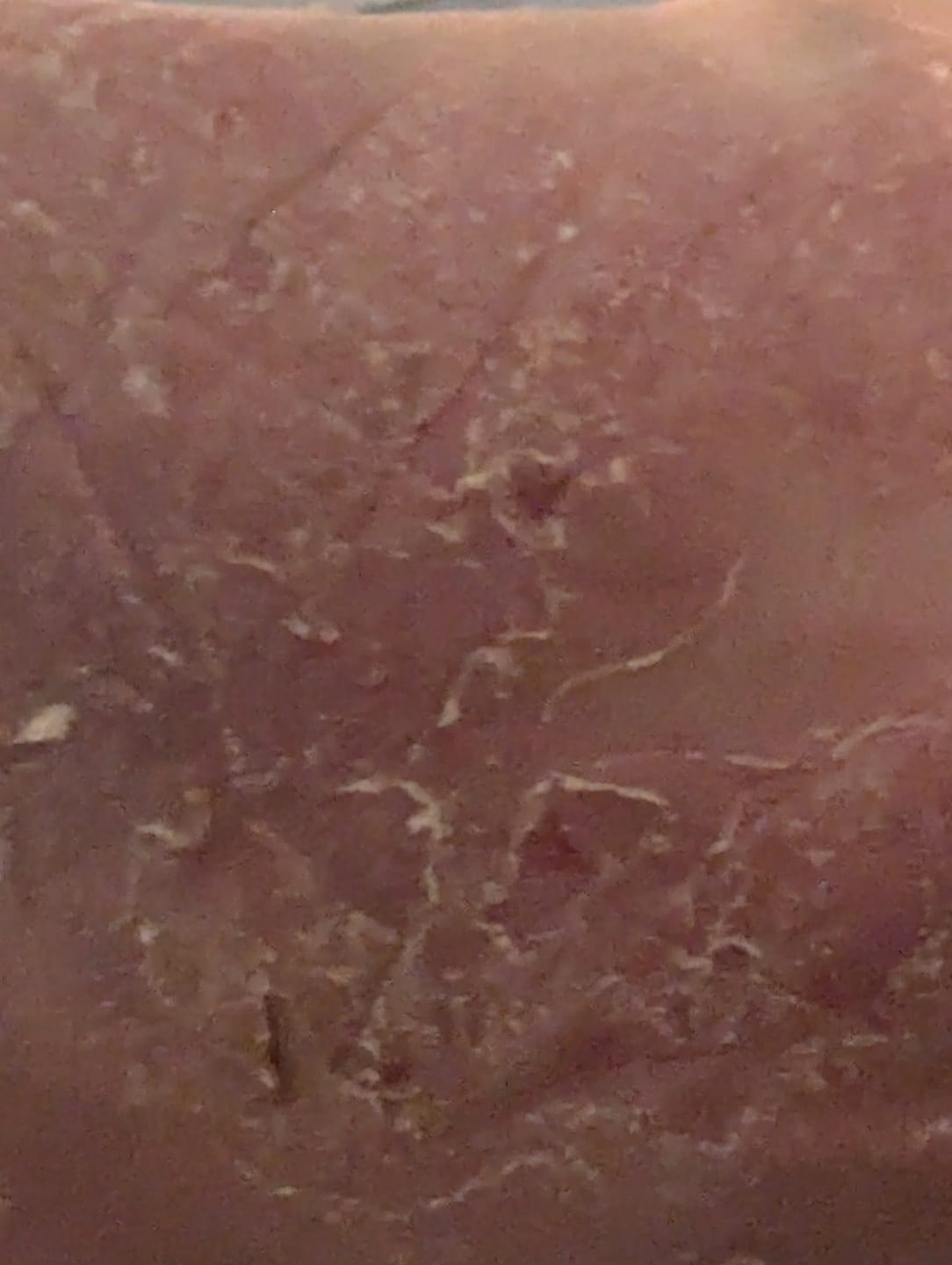 Customer photo review of Calm Cream